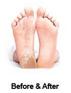 Baby Foot Exfoliating Peel Kit - Mary Turner Day Spa & Boutique
